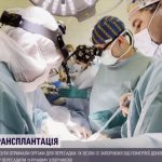 video transplantatsiya